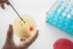 How Immature Granulocytes Can Indicate Serious Health Conditions: A Detailed Guide